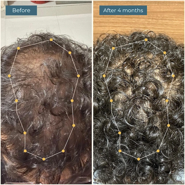 Hair Vitamin with AnaGain™ & Biotin